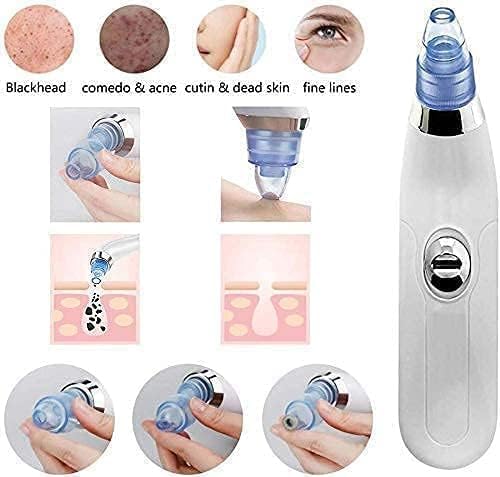 Derma Suction – Professional Pore Cleaner & Blackhead Remover Vacuum